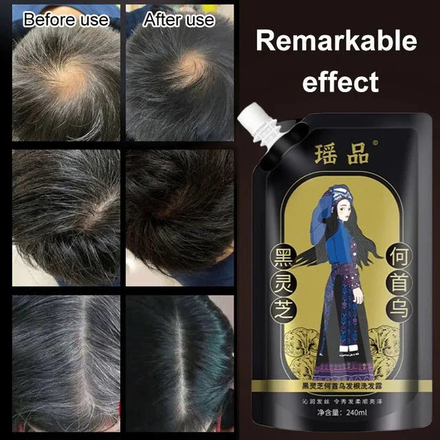 Anti-Hair Loss Hair Shampoo 600 ml ( Buy 1 Get 2 Free )