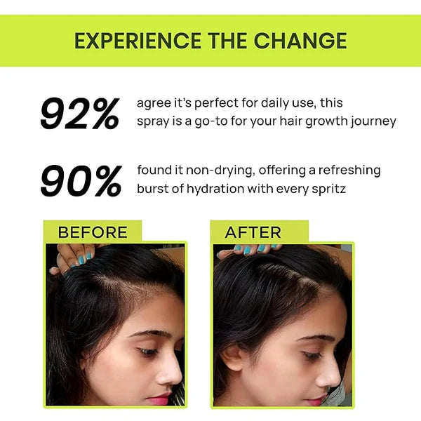 🔥BUY 1 GET 2 FREE🔥-🌿 Rosemary Water Hair Spray for Regrowth 🌿