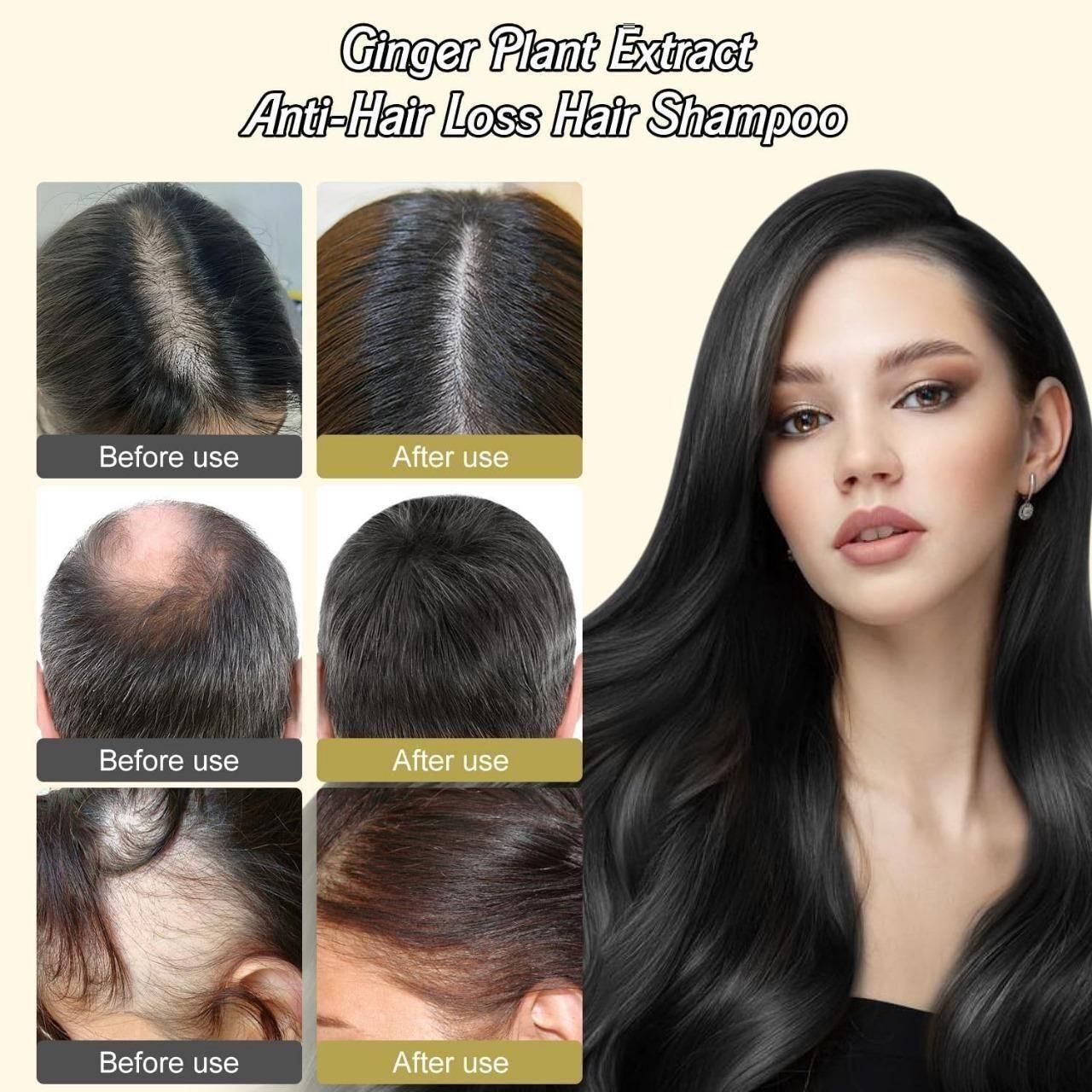 Anti-Hair Loss Hair Shampoo 600 ml ( Buy 1 Get 2 Free )