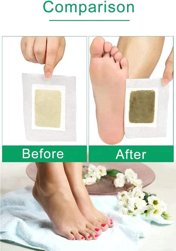 Detox Foot Patches (Set of 10)