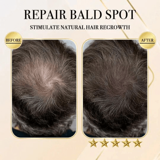 Natural Grey Reverse Shampoo Bar (Buy 1 get 1 Free) 🔥 VERY LIMITED STOCK AVAILABLE AT 549/- 🔥BUY NOW -- DON'T MISS🔥