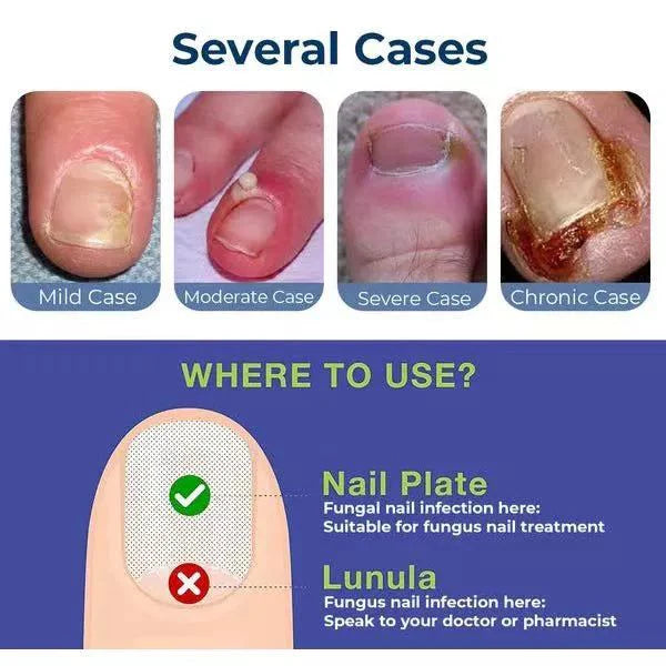 𝗔𝗻𝘁𝗶 𝗣𝗮𝗿𝗼𝗻𝘆𝗰𝗵𝗶𝗮 𝗥𝗲𝗹𝗶𝗲𝗳 𝗢𝗶𝗹 - (𝗕𝘂𝘆 𝟭 𝗚𝗲𝘁 𝟭 𝗙𝗥𝗘𝗘🔥🔥)