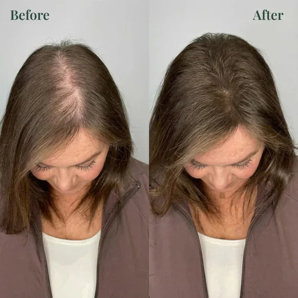 𝐊𝐞𝐫𝐚𝐫𝐨𝐬𝐞 𝐑𝐨𝐬𝐞𝐦𝐚𝐫𝐲 𝐒𝐡𝐚𝐦𝐩𝐨𝐨 𝐅𝐨𝐫 𝐇𝐚𝐢𝐫 𝐆𝐫𝐨𝐰𝐭𝐡 ( 𝐁𝐮𝐲 𝟏 𝐆𝐞𝐭 𝟏 𝐅𝐫𝐞𝐞 🔥)