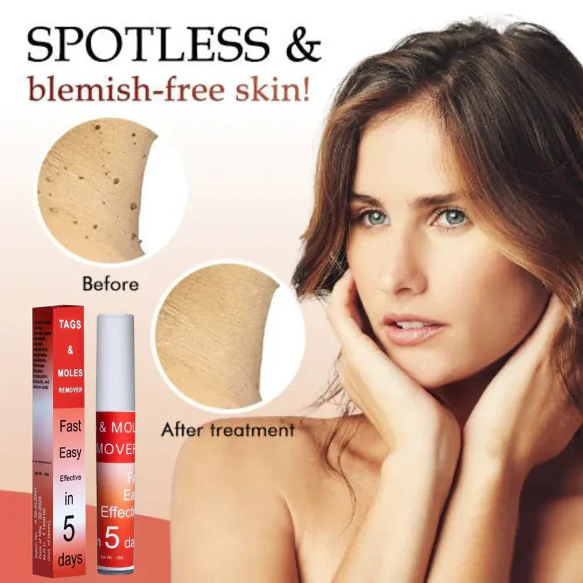 𝐋𝐎𝐕𝐈𝐋𝐃𝐒™ 𝐓𝐚𝐠𝐬 & 𝐌𝐨𝐥𝐞𝐬 𝐑𝐞𝐦𝐨𝐯𝐞𝐫 ( 𝐁𝐮𝐲 𝟏 𝐆𝐞𝐭 𝟏 𝐅𝐫𝐞𝐞🔥🔥) 𝐒𝐚𝐯𝐞 𝐑𝐬. 𝟗𝟎𝟎.𝟎𝟎