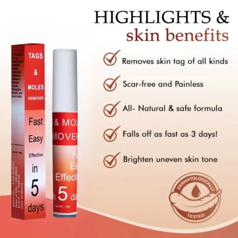 𝐋𝐎𝐕𝐈𝐋𝐃𝐒™ 𝐓𝐚𝐠𝐬 & 𝐌𝐨𝐥𝐞𝐬 𝐑𝐞𝐦𝐨𝐯𝐞𝐫 ( 𝐁𝐮𝐲 𝟏 𝐆𝐞𝐭 𝟏 𝐅𝐫𝐞𝐞🔥🔥) 𝐒𝐚𝐯𝐞 𝐑𝐬. 𝟗𝟎𝟎.𝟎𝟎